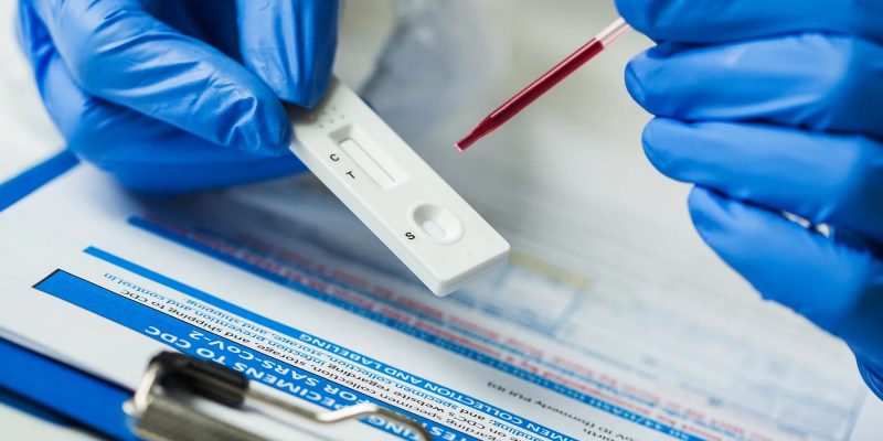 Heimtests erkennen die neue COVID-Variante, können aber länger dauern