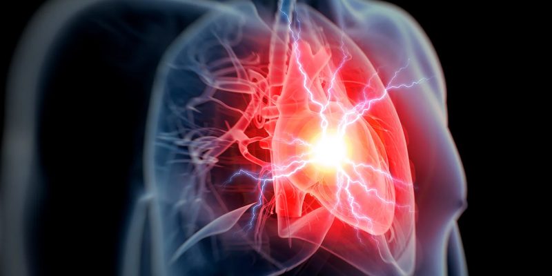 Brustschmerzen und andere Anzeichen