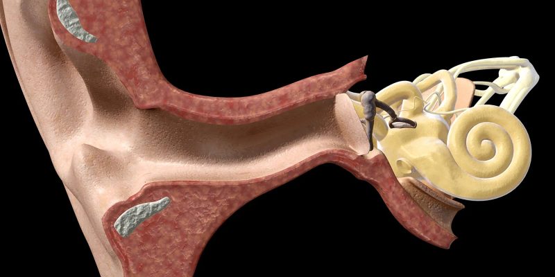 Für viele ist das Stigma des Hörverlusts problematisch; Hier ist, was helfen kann