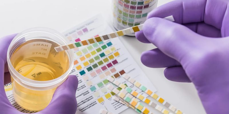 Wird es dazu führen, dass ich bei einem Drogentest durchfalle?