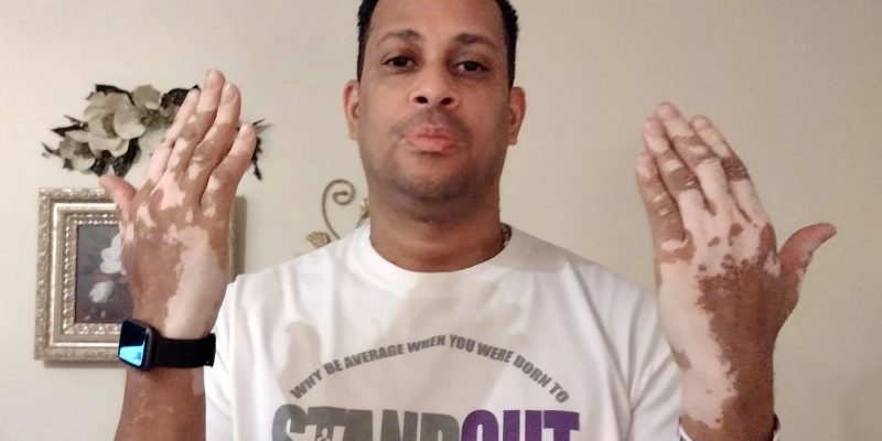 Mein Leben mit dieser Hauterkrankung