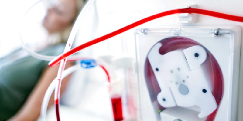 Meine Dialysemaschine funktioniert vorerst wie meine Nieren