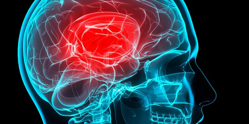 Wie ich chronische Migräne unter Kontrolle bekam