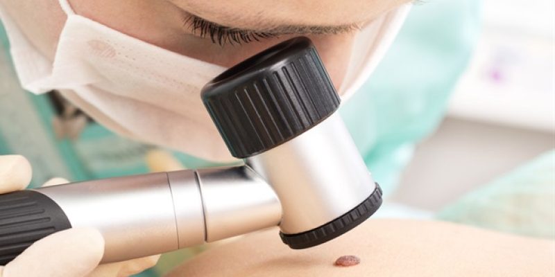 Es wurde festgestellt, dass das Ziel eines Immun-Checkpoint-Inhibitors das Wachstum von Hautkrebs fördert