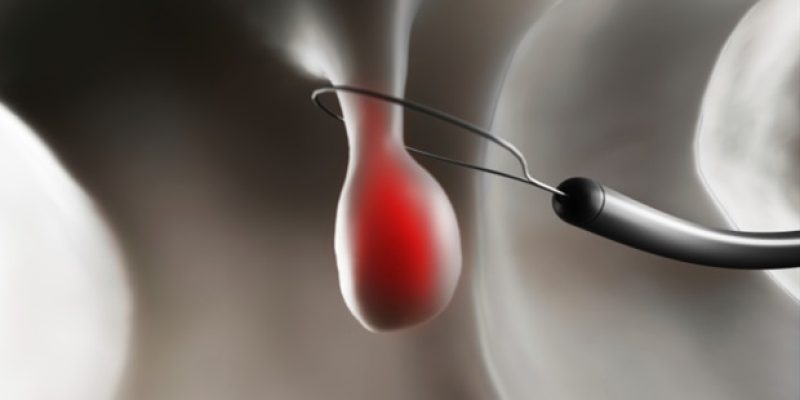 Autsch.  Diese „kostenlose“ jährliche Untersuchung könnte Sie etwas kosten.  Hier ist der Grund.