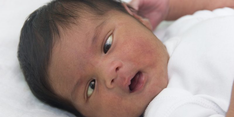 Schielendes Baby: Was es bedeutet und was zu tun ist