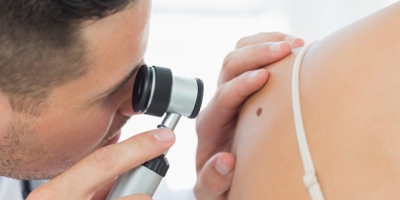 Wissenschaftler identifizieren einen neuen Ansatz zur Behandlung von Sarkoidose