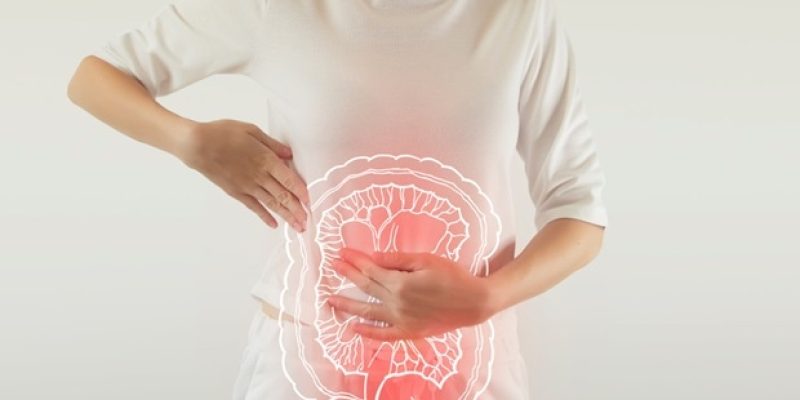 Neue biotechnologische Strategie zeigt Potenzial zur Behandlung von Colitis ulcerosa