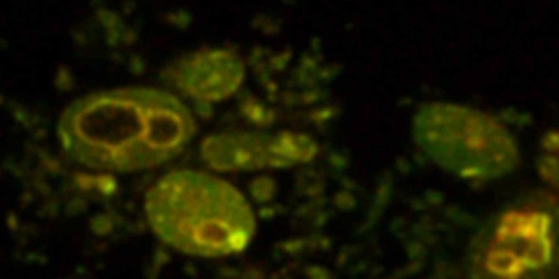 Forscher stellen künstliche Zellen mit Potenzial für die Arzneimittelabgabe und Gewebezüchtung her