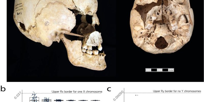 Alte DNA enthüllt erste prähistorische Fälle des Turner- und Jacob-Syndroms