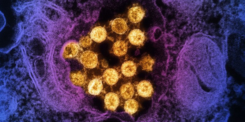 Studie legt nahe, dass die Ausbreitung der JN.1-Variante nicht auf eine verstärkte Immunflucht zurückzuführen ist