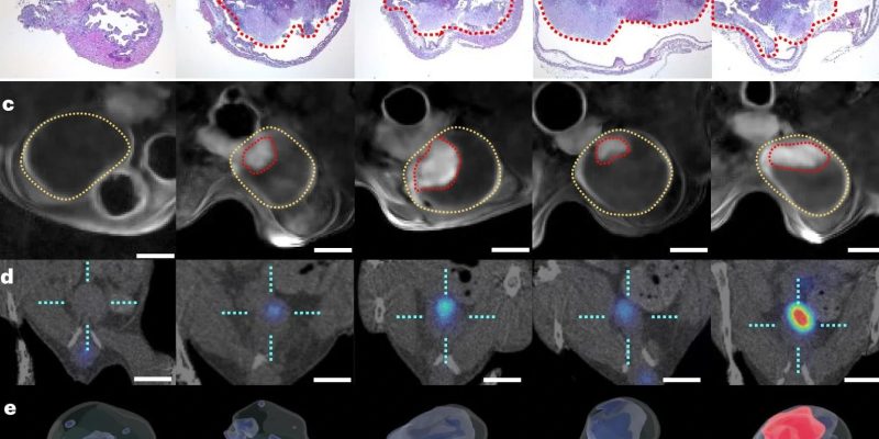 Nanobots zur Behandlung von Blasenkrebs versprechen hohe Wirksamkeit und gezielte Verabreichung