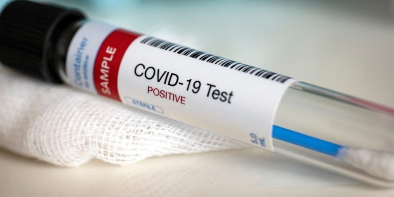 Der innovative COVID-19-Testprototyp nutzt Biolumineszenz für schnellere Ergebnisse