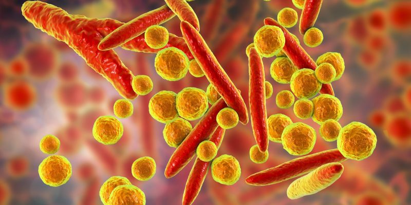 In den Niederlanden kommt es zu einem unerwarteten Anstieg der Mycoplasma pneumoniae-Fälle, wobei die jüngere Bevölkerung stärker betroffen ist