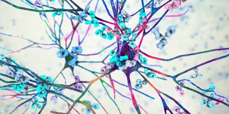 Xist-lncRNA als Hauptauslöser bei weiblichen Autoimmunerkrankungen identifiziert