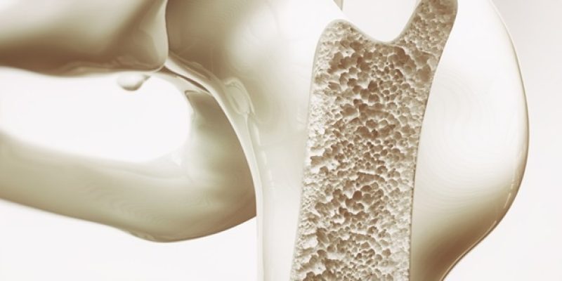 Biomimetische Gerüste bieten Hoffnung auf die Reparatur von Schädeldefekten