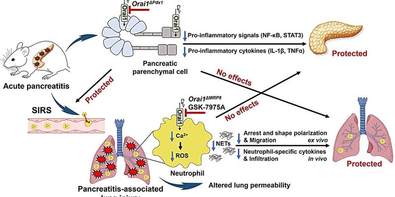 Es wurde festgestellt, dass die Veränderung des Schlüsselionenkanals vor Pankreatitis-assoziierten akuten Lungenschäden schützt