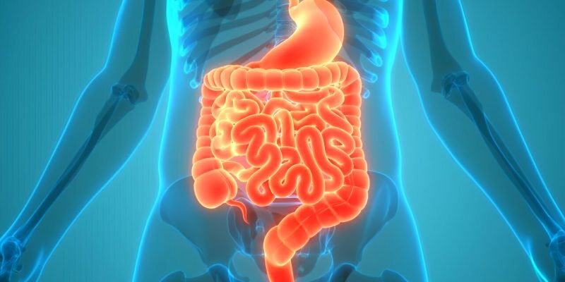 Bohnen sind vorteilhaft für Patienten mit kolorektalen Neoplasien in der Vorgeschichte