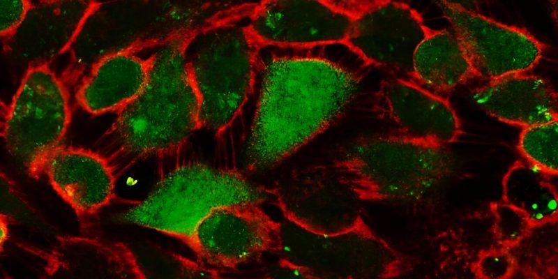 Aufopferungsverhalten von Brustkrebszellen als mögliche Ursache für einen Rückfall entlarvt