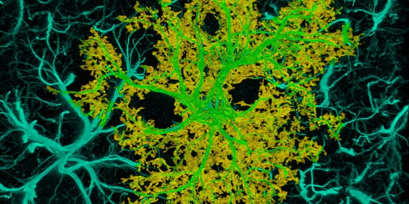 Könnte ein bereits zugelassenes Medikament den Opioidkonsum nach einer Operation reduzieren?