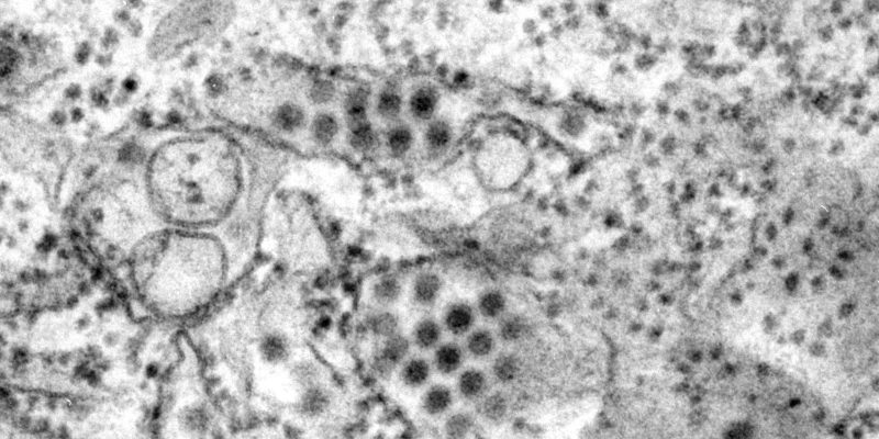 Brasilien verzeichnet im Vorfeld der Impfkampagne eine Vervierfachung der Dengue-Fälle