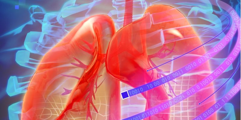 Eine neuartige Methode zur Lungenbildregistrierung