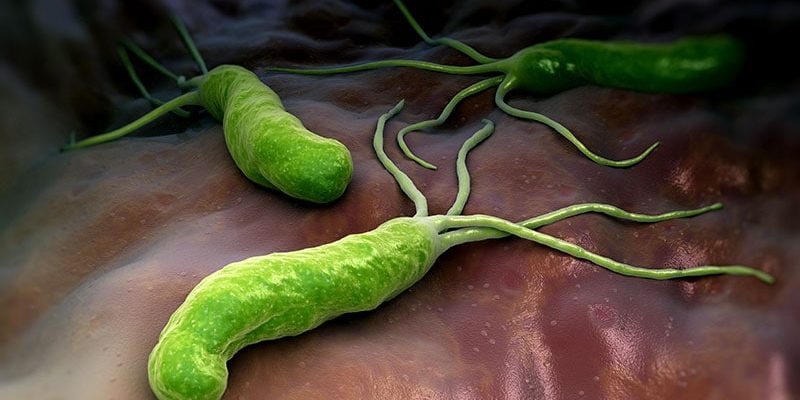 Eine H-pylori-Infektion ist mit einem erhöhten Alzheimer-Risiko verbunden