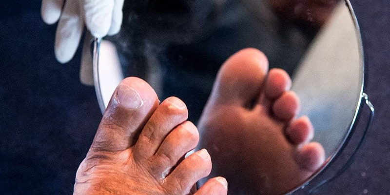 Neues Tool bietet möglicherweise einen Diagnosevorteil bei diabetischer Neuropathie