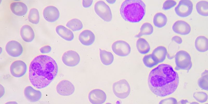 CRISPR-basierte Gentherapie erhält Zulassung für Beta-Thalassämie