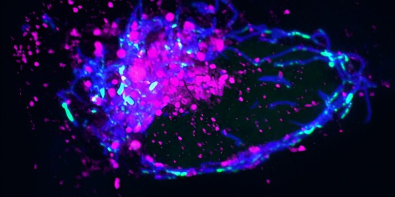 Es wurde festgestellt, dass ein fehlerhaftes DNA-Entsorgungssystem Entzündungen verursacht