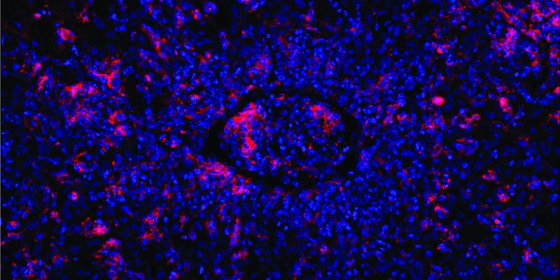 Durch die Genbearbeitung werden Immunzellen gezielt repariert