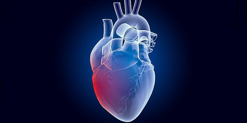 CHIP an HFpEF und ASCVD gebunden: Was ist der Zusammenhang?