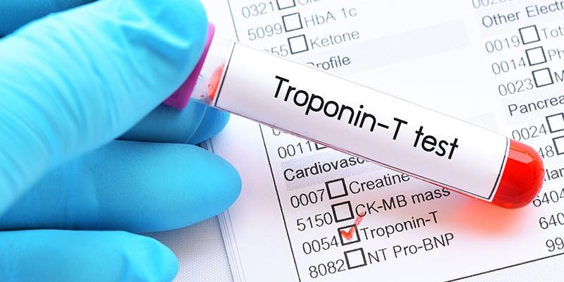Hochempfindliches Troponin bietet AMI Diagnostic Edge