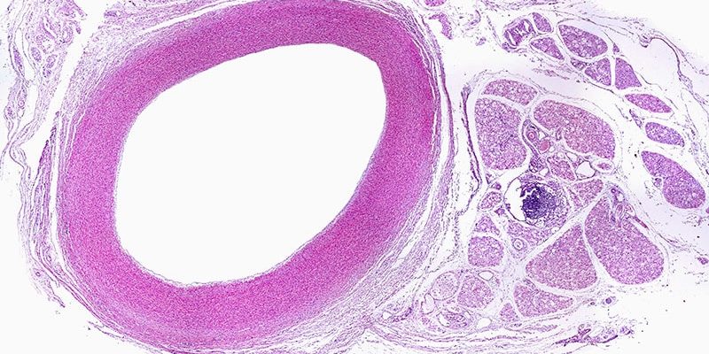 „Die gesündesten Arterien der Welt“ erwiesen sich als die elastischsten