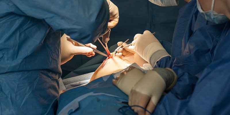 Magnetische Seeds/Führungsdrähte zur Lokalisierung von Brustkrebs?