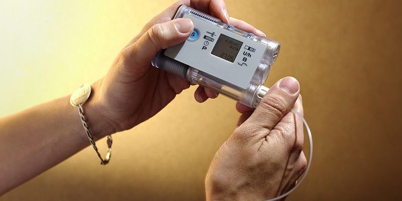 Automatische Hybrid-Insulinabgabesysteme helfen bei der Bewältigung von Typ-1-Diabetes