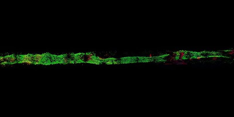 „Heart-on-a-chip“, um Chemotherapien und andere Krebsmedikamente auf Herztoxizität zu testen