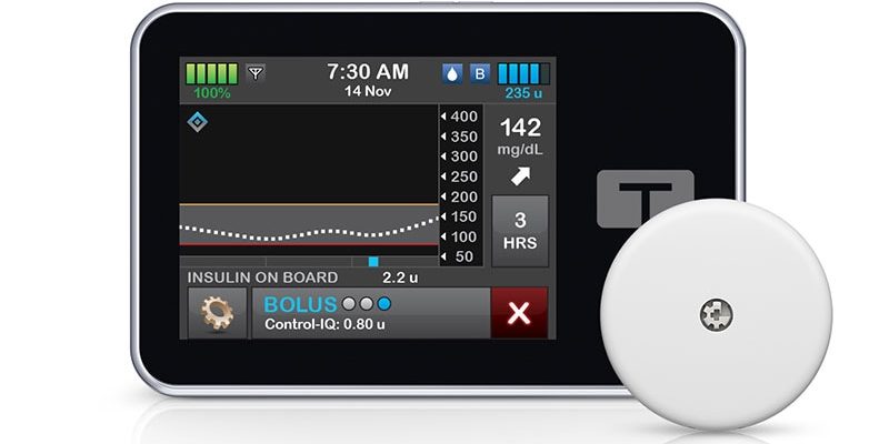 Das Tandem-Insulinpumpensystem lässt sich in den Libre-Sensor integrieren