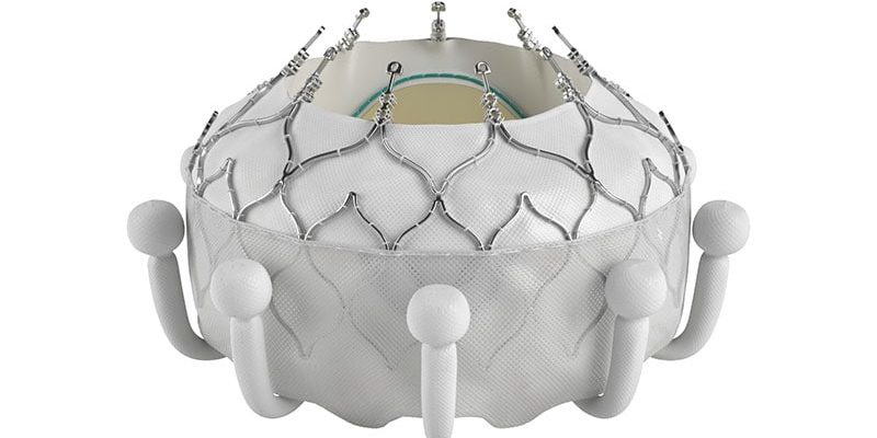 FDA genehmigt ersten Transkatheter-Trikuspidalklappenersatz