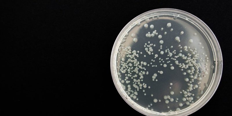 Forschungsteam nutzt KI, um die Erkennung von Sepsis und eine wirksame Behandlung zu verbessern