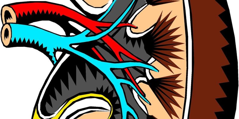 Die Klasse der Diabetes-Medikamente ist mit einem geringeren Risiko für Nierensteine ​​verbunden