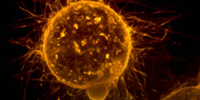 Forscher entdecken, dass der epigenetische Status die Metastasierung bestimmt