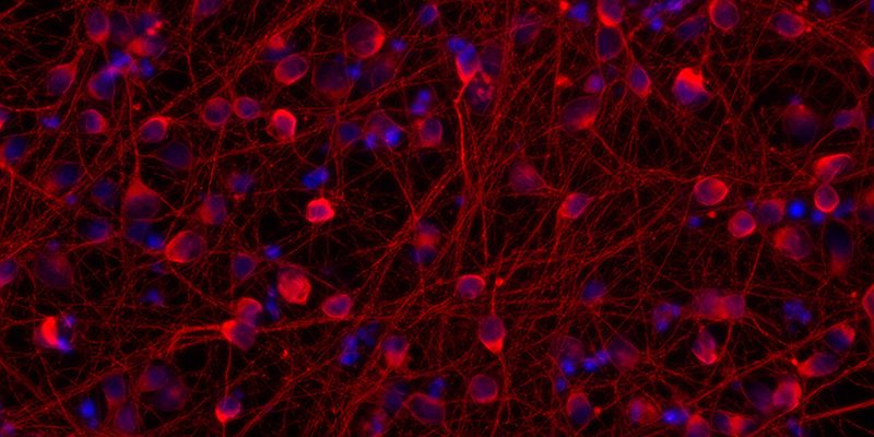 Forscher hacken die inneren Uhren von Neuronen, um die Erforschung neurologischer Erkrankungen zu beschleunigen