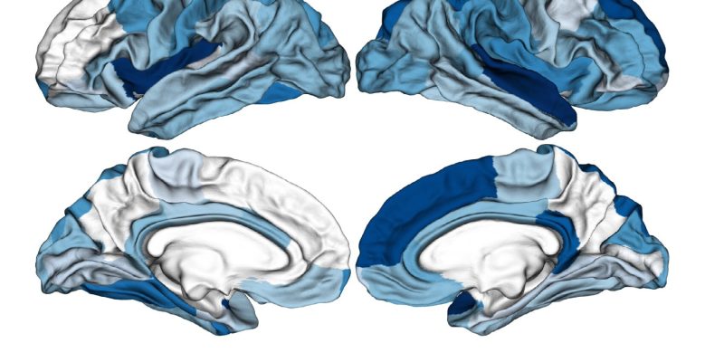 Forscher entwickeln einen auf maschinellem Lernen basierenden Klassifikator, der bei der Frühdiagnose von Psychosen helfen könnte