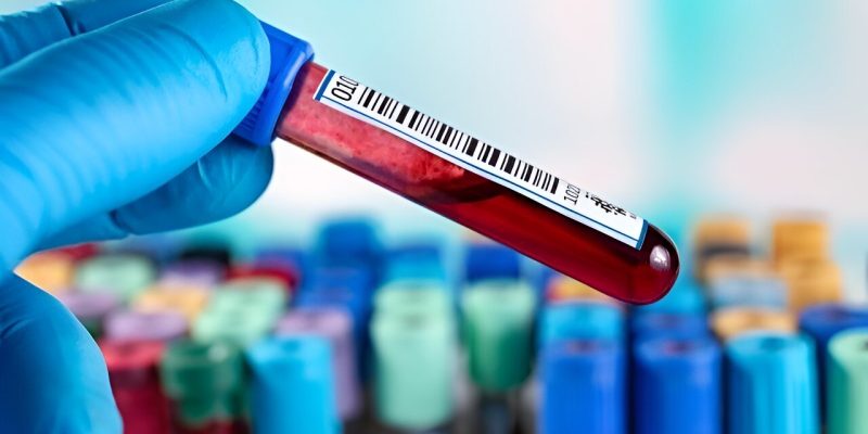 Empfehlungen für Tests zur Unterstützung der Syphilis-Diagnose