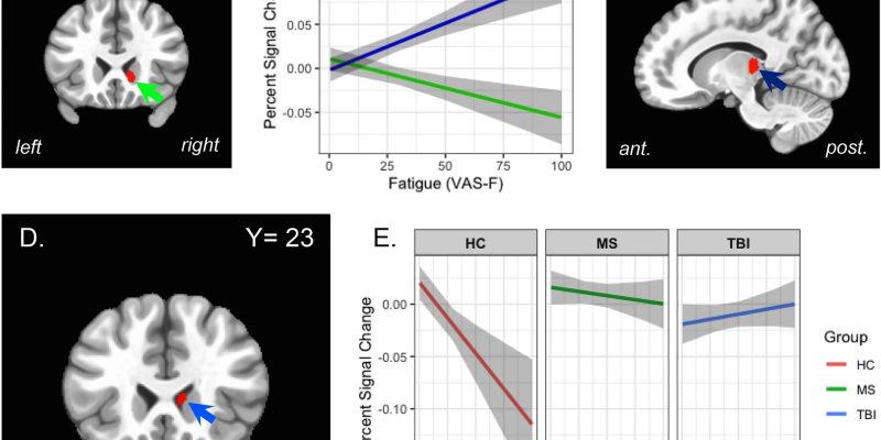 Die Untersuchung der kognitiven Ermüdung bei verschiedenen Aufgaben und Bevölkerungsgruppen liefert neue Erkenntnisse