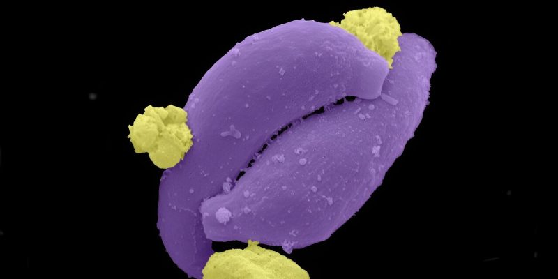 Hochempfindliche Instrumente erkennen asymptomatische Malaria
