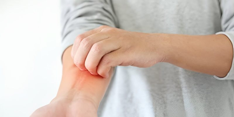 Aktualisierte Leitlinien zur Behandlung von atopischer Dermatitis veröffentlicht