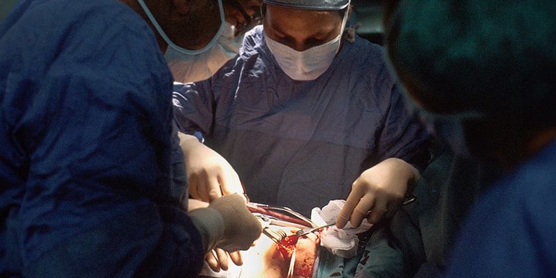 Wird die Achselchirurgie wegen der Abemaciclib-Kandidatur zu häufig eingesetzt?