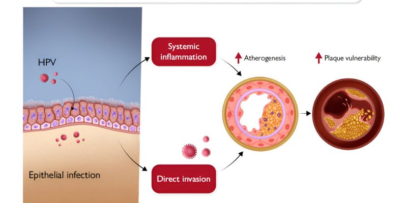 Laut einer Studie besteht für Frauen mit einer HPV-Infektion ein höheres Risiko, an Herz-Kreislauf-Erkrankungen zu sterben